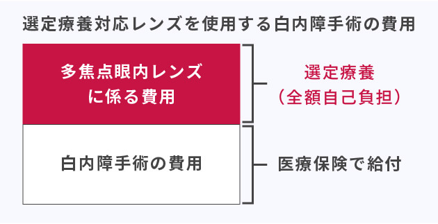選定医療対応の多焦点眼内レンズを使用する白内障手術の費用